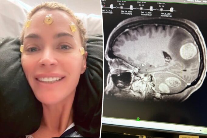 Teddi Mellencamp выявляет «больше опухолей» из мозга, чем первоначально ожидалось: «Этот бой не закончился»