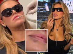 Брукс Надер растворяет весь свой наполнитель для губ в качестве «рождественского подарка маме и папе»