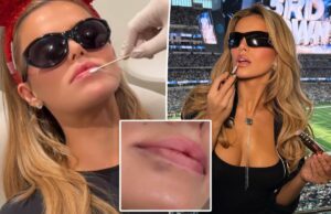 Брукс Надер растворяет весь свой наполнитель для губ в качестве «рождественского подарка маме и папе»