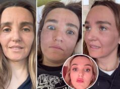 Хлоя Файнман поделилась «неудачными» фотографиями «сумасшедшего дерьма», которое она сделала со своим лицом