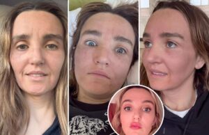 Хлоя Файнман поделилась «неудачными» фотографиями «сумасшедшего дерьма», которое она сделала со своим лицом