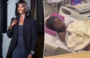 Супермодель Анок Яй, 28 лет, перенесла «жизненно важную процедуру» из-за сепсиса после операции на легких