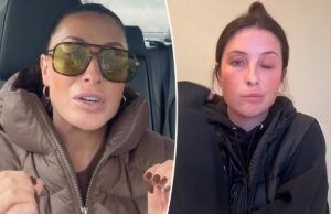 Бристоль Пэйлин рассказывает об удивительных преимуществах паралича лицевого нерва спустя год после загадочного состояния