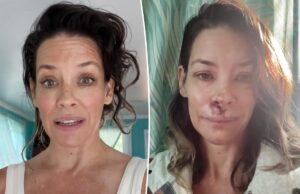 Эванджелин Лилли делится планом лечения после черепно-мозговой травмы: «Я потратила много денег»