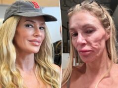 Брэнди Гланвилл дебютирует в новом образе после ужасного обезображивания лица