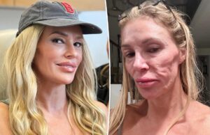 Брэнди Гланвилл дебютирует в новом образе после ужасного обезображивания лица